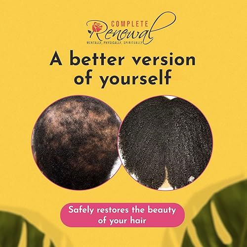 Postpartum & Alopecia Support: Natural Hair Growth Oil & Derma Roller System