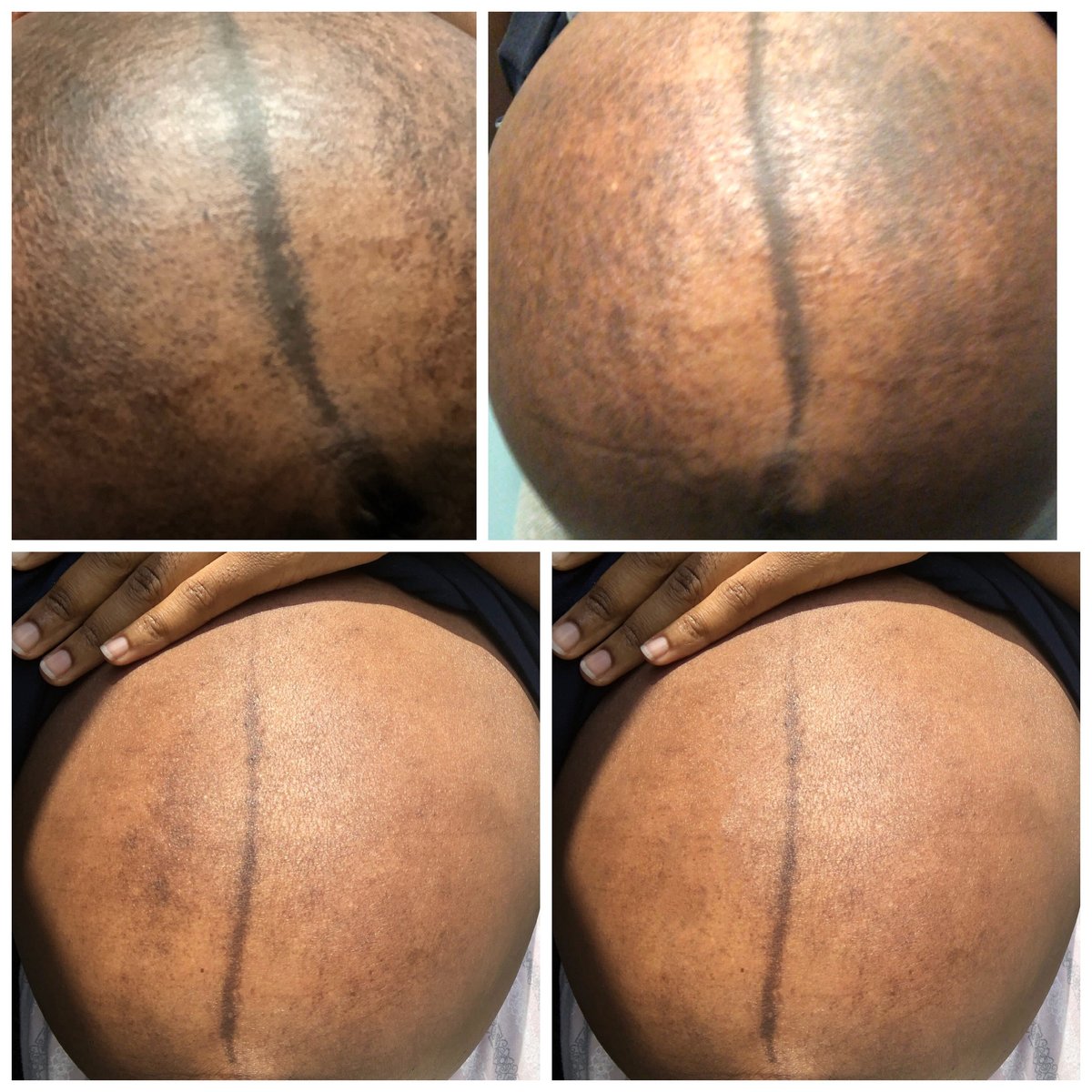 GLOW Brightening Scrub - Turmeric, Honey, Kelp Face & Body Exfoliator