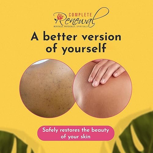 Brightening Turmeric Body Butter for Dark Spots & Hyperpigmentation