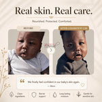 Before and after photos of a baby's cheeks, dry and rough before, smoother after consistent use of the balm