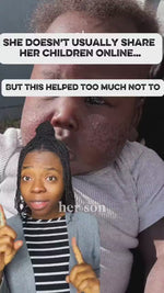 Founder video about her son's dry, irritated skin and the balm she made for him